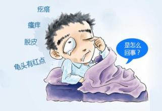 龟头炎