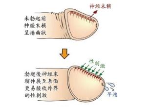 早泄