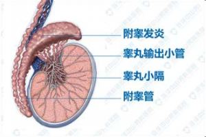 附睾炎