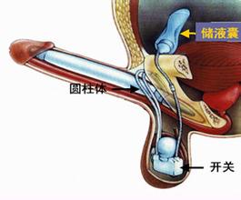 勃起功能障碍